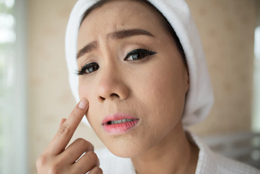 9 Ciri-Ciri Skincare Tidak Cocok Digunakan, Apa Kamu Mengalaminya?