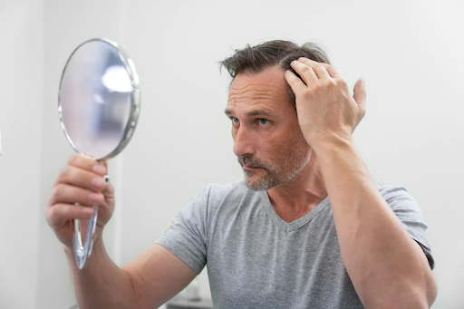 5 Cara Jitu dan Efektif Atasi Rambut Kering Pria dan Rekomendasi Produknya