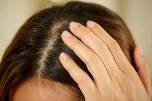 Scalp Treatment adalah Solusi Jitu Rawat Kulit Kepala dan Rambut Sehat, Ini Tipsnya!