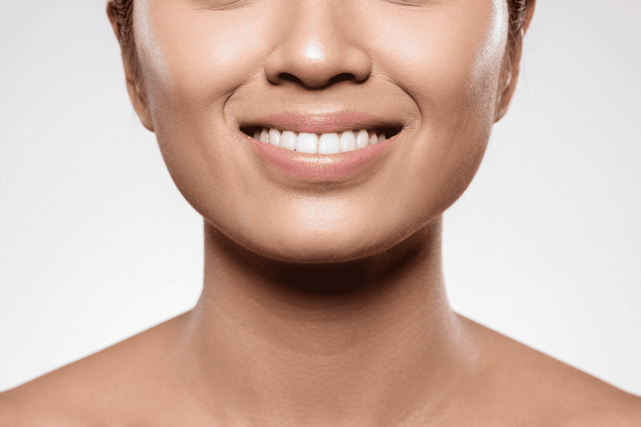 Apa Itu Smile Line? Kenali Penyebab dan Cara Mengatasinya