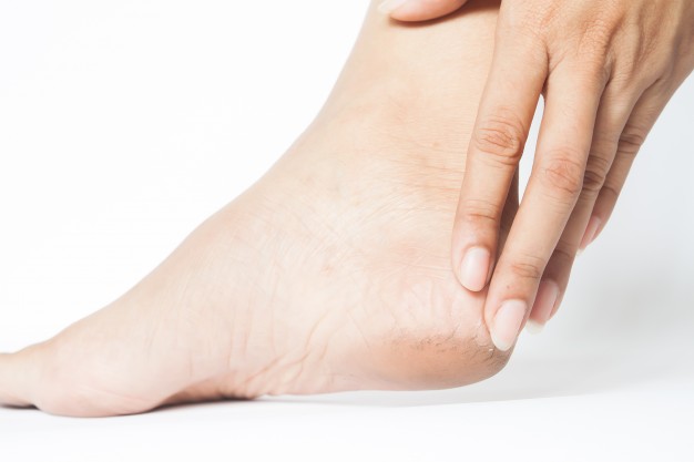 Kaki Pecah Pecah: Penyebab, Cara Mengatasi, dan Rekomendasi Foot Care