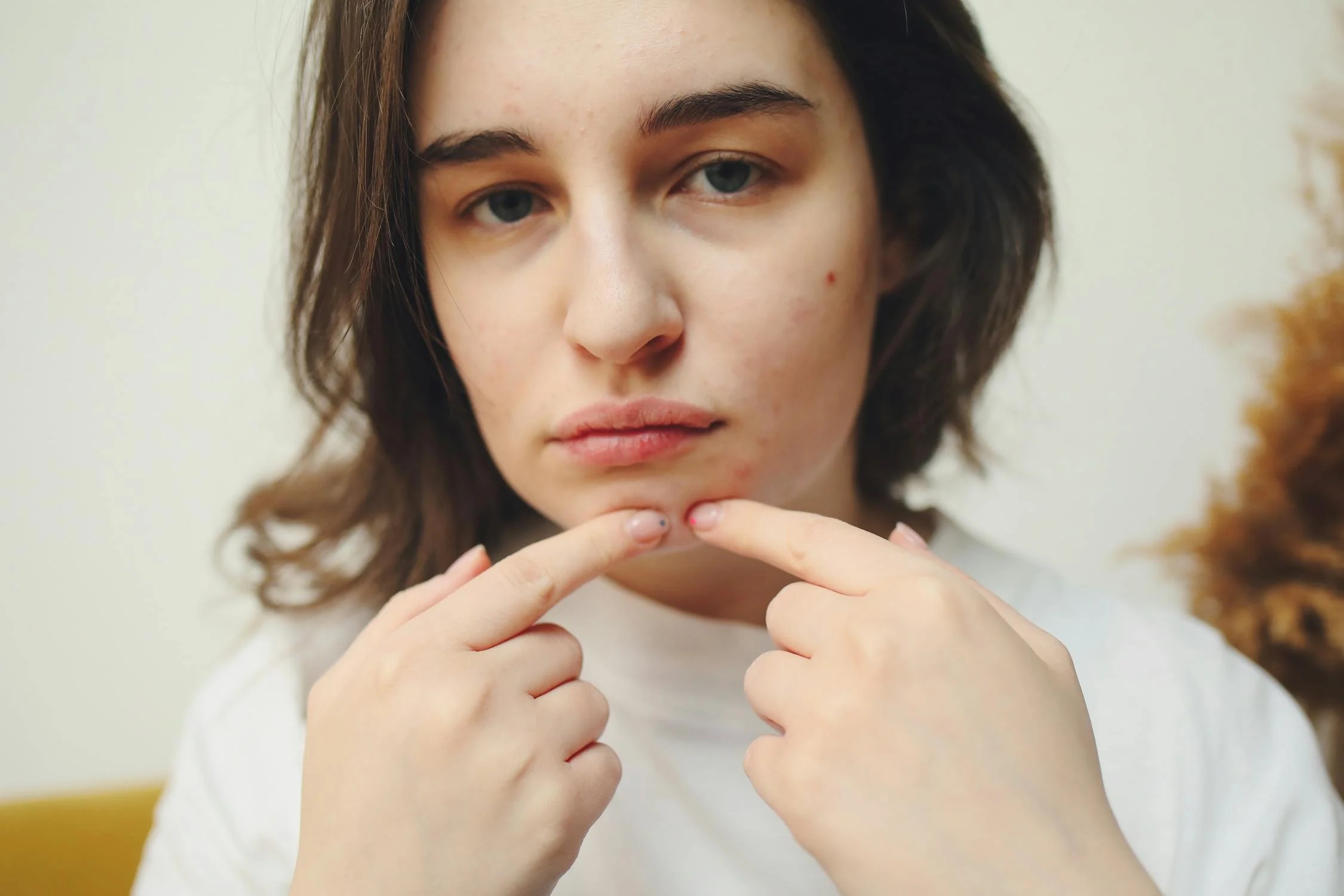 5 Skincare Kulit Kering Bruntusan, dari Toner sampai Sunscreen